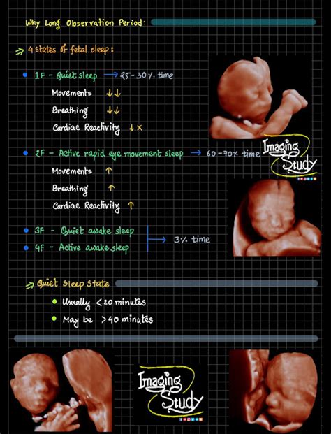 Imaging Study Fetal Biophysical Profile Bpp