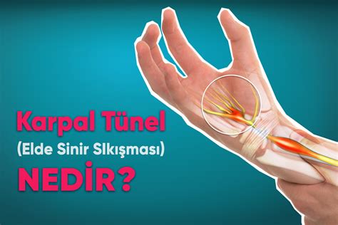 Elde Sinir Sıkışması Karpal Tünel Sendromu Nedir Belirtileri