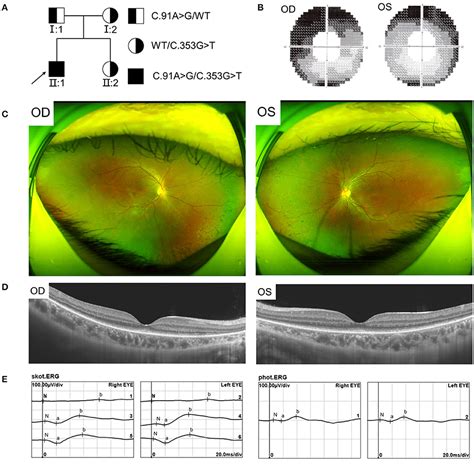 Frontiers Autosomal Recessive Rod Cone Dystrophy Associated With