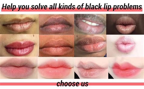 understanding skin sensitivity choosing   bleaching cream