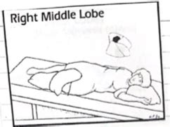 Chest PT Practical Flashcards | Quizlet