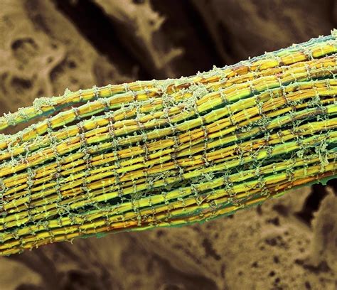 Skeletal Muscle Fibres Photograph By Steve Gschmeissner Pixels