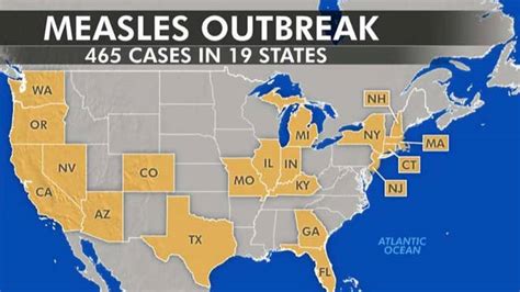 Medical Experts Blaming Anti Vaxxers For Nationwide Measles Outbreak