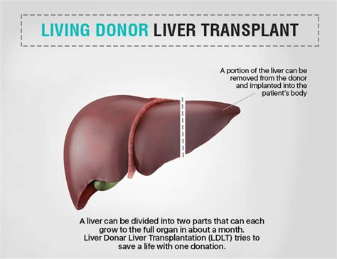 Best Pediatric Liver Transplant Dr Vivek Vij Ailbs India