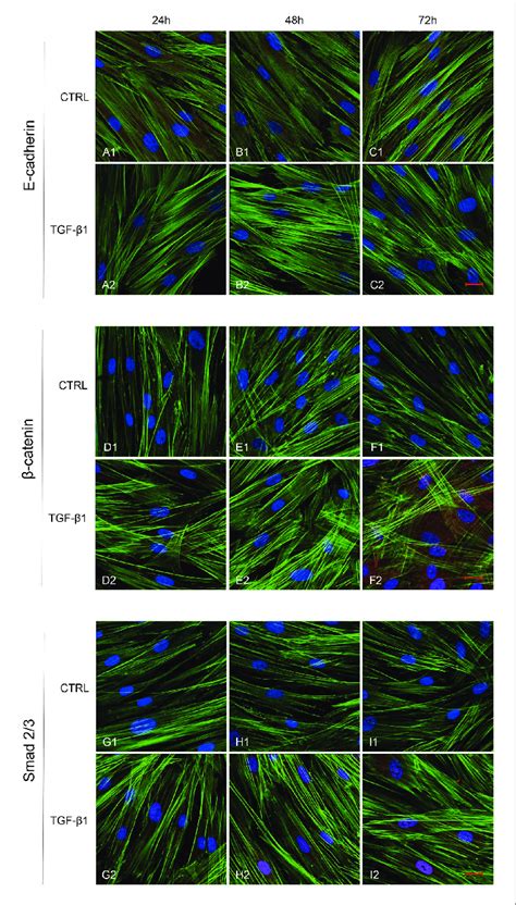 Human GFs uninduced and induced with TGF β1 10 ng ml were observed