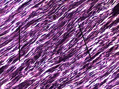 Elastic Cartilage Histology