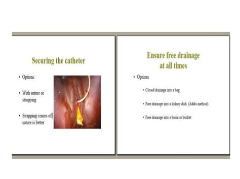 Obstetrics Fistula