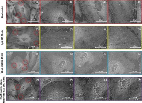 Sem Images Of Actin Filament Structures Of A Single Lung Ec Image