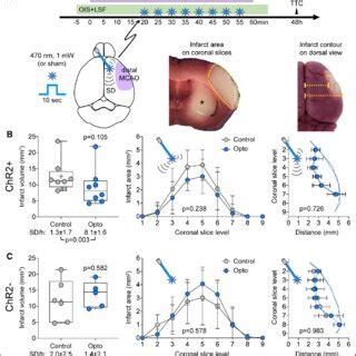 Optogenetic Spreading Depolarization Sd Induced Cerebral Blood Flow