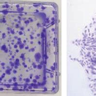 Effects Of UA Treatment On TSPC Viability And Survival Characteristics