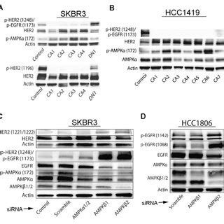 Aicar Inhibits The Growth And Reduces Survival Of Egfr And