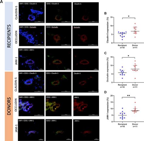 Tight Junction Protein Expression In Subcutaneous Adipose Tissue A