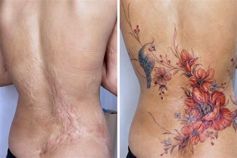 50 Times People Asked To Cover Up Their Scars And This Tattoo Artist Nailed It New Pics Artofit