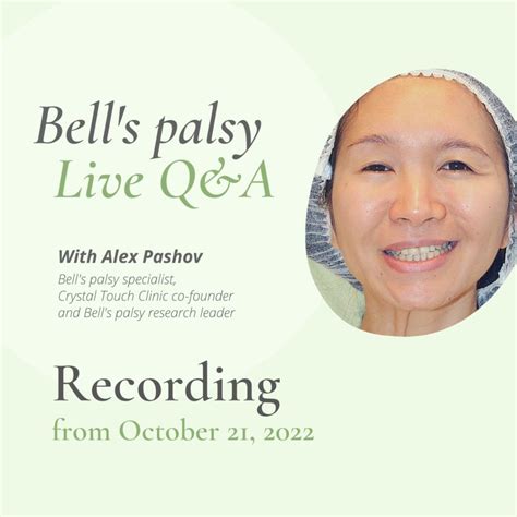 Long Bells Palsy Recovery Timeline With Photos • Crystal Touch Bells Palsy Clinic