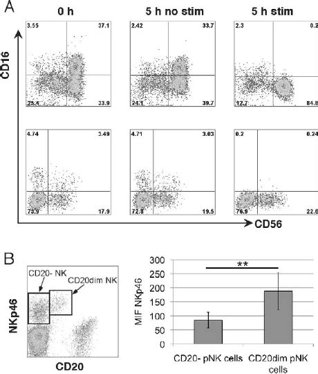 Low CD16 expression and dim CD20 expression on NK cells could be ...