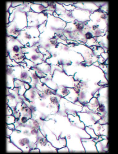 Tissues Histology Photos Connective Tissue Proper Loose Reticular