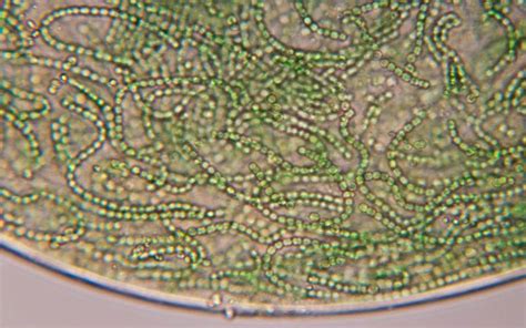 Cianobacterias Qu Son Caracter Sticas Morfolog A Toxicidad Ejemplos