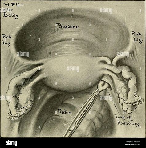 Round Ligament Of Uterus Cadaver