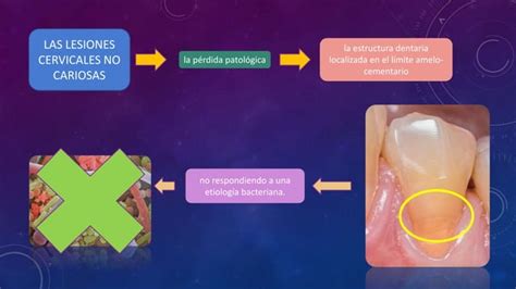 Lesiones Cervicales No Cariosas Ppt