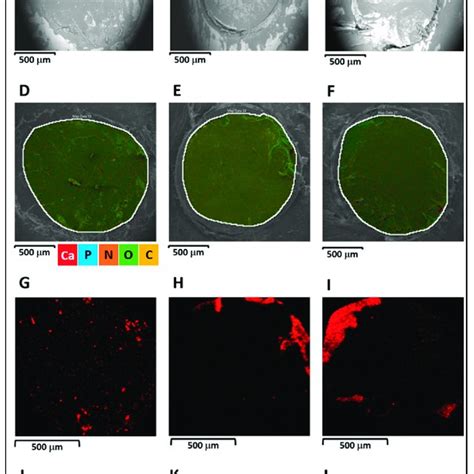 Bs Sem Images A C Multi Element Edx Mapping D F Calcium Edx