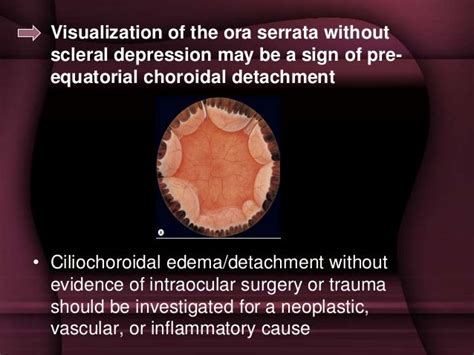 Choroidal detachment