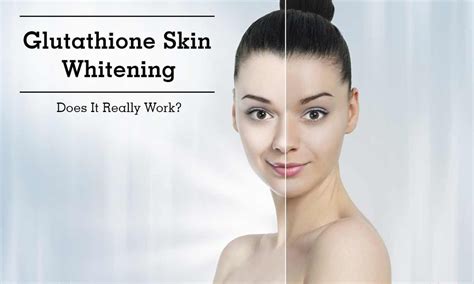 Skin Whitening Benefits Of Glutathione Injections