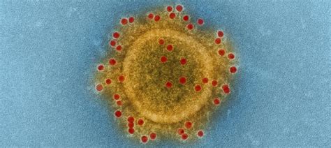 Coronavirus May Eat Into Global Fdi Flow Predicts Unctad