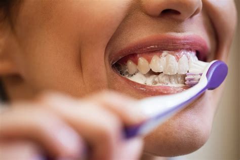 10 Maneiras Naturais De Clarear Seus Dentes Em Casa 42 OFF