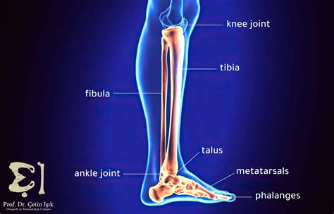 Leg fracture, how to determine its type and methods of treatment - Dr ...