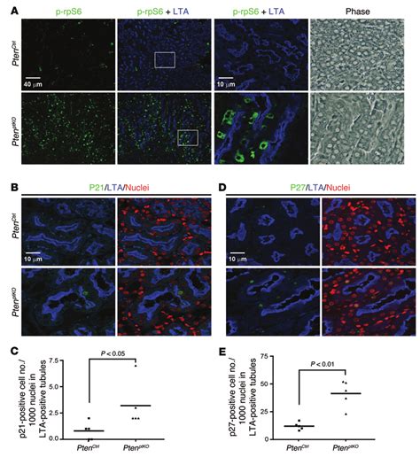 Renal Proximal Tubule Specific Pten KO Increases RpS6 Phosphorylation