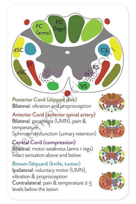 Oren Gottfried Md On Twitter Spinal Cord Basics By Sketchy Med