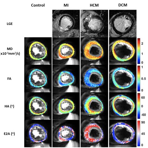 Cardiovascular Magnetic Resonance Imaging Emerging Techniques And