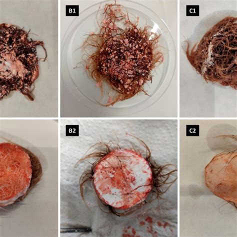 Morphology Of R Graeca Hairy Roots In Vitro Cultured For Days With