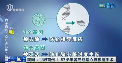 全球首例！為了活下去，他移植了豬的心臟！為什麼是豬不是靈長類？ 壹讀