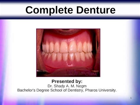 Ppt Plete Denture Power Point Dokumentips