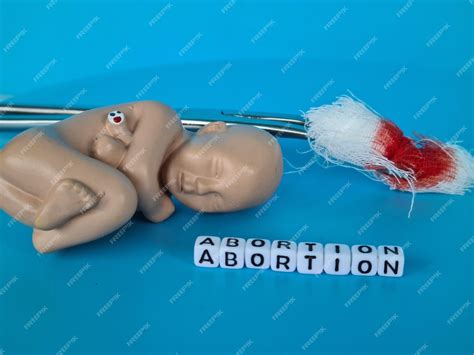 premium photo surgical abortion  complex operation  clinic