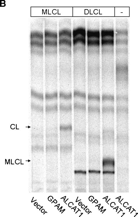 The Microsomal Cardiolipin Remodeling Enzyme Acyl Coa Lysocardiolipin