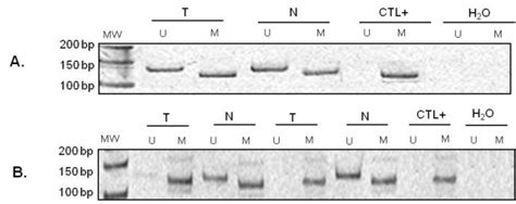 Methylation Of The P14 Arf Promoter In Tumors And Normal Colon Mucosa