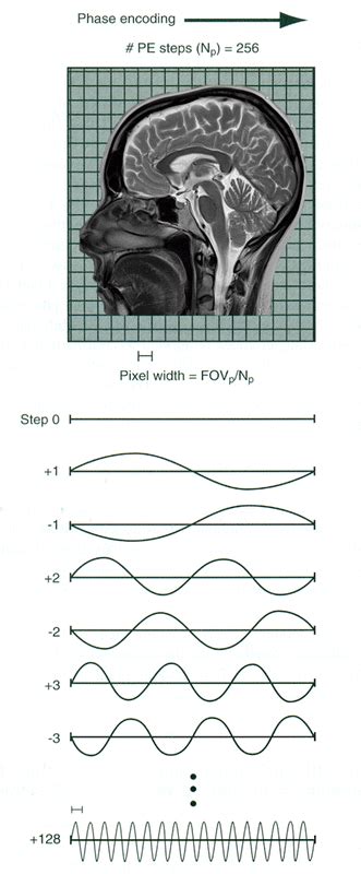 Phase And Frequency Encoding Questions And Answers In Mri