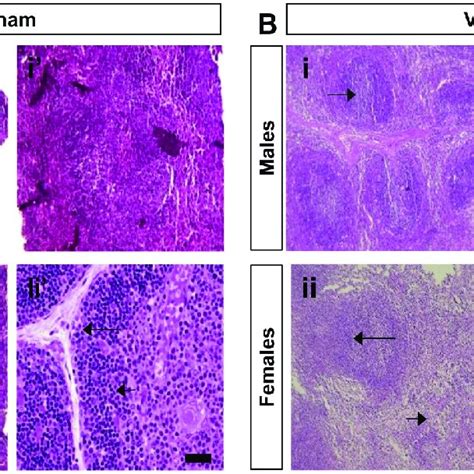 Histopathological Analysis In Hematoxylin And Eosin H E Stained