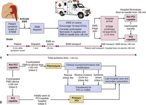 St Elevation Myocardial Infarction Thoracic Key