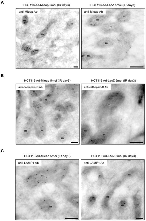 Post Embedding Immunoelectron Microscopic Analysis Shows The Presence