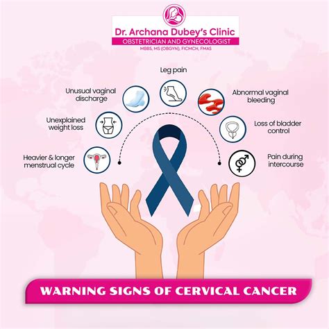 Dr. Archana Dubey - Your Health Deserves Attention Leg pain, unusual