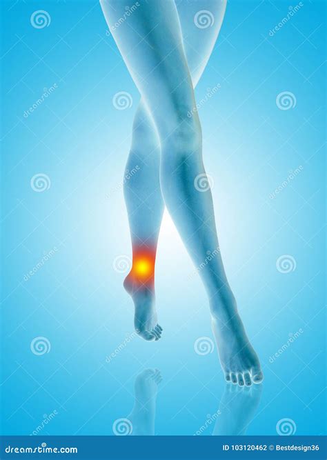 Woman Girl Legs and Feet with a Hurt Ankle Pain Stock Illustration