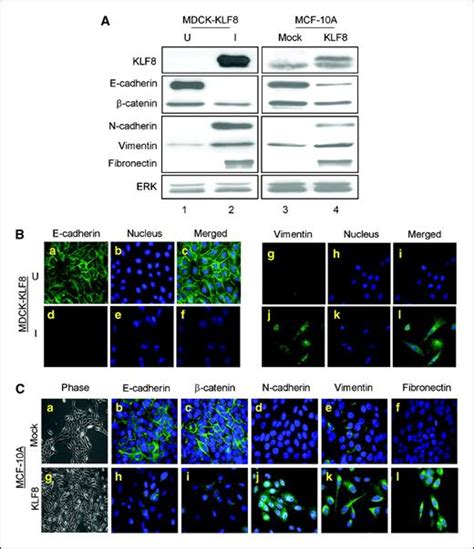 Krüppel Like Factor 8 Induces Epithelial To Mesenchymal Transition And