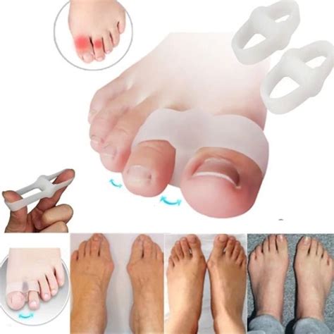 Jual Pelurus Jempol Jari Kaki Korektor Bunion Hallux Valgus Type 2