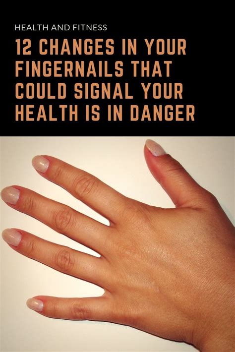 15 Health Warning Signs From Your Fingernails Fingernail Health Signs