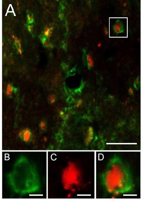 Photomicrographs Of Immunofluorescent Staining In The Lateral Portion