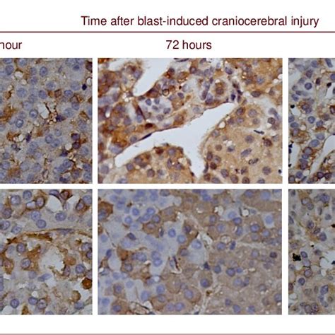 Aquaporin 4 Expression In The Pituitary Gland After Blast Induced