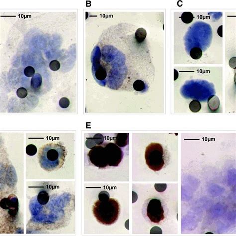 (PDF) Analysis of Circulating Tumor Cells in Patients with Non-small ...